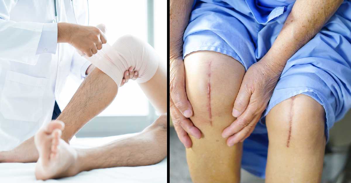 Top 5 Mistakes After Knee Replacement to Avoid Further Possibility of Problems - rewiewtrends